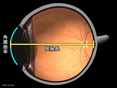 角膜曲率と眼軸長