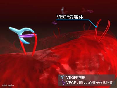 VEGF受容体と阻害剤２