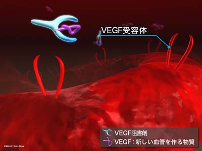 VEGF受容体と阻害剤３